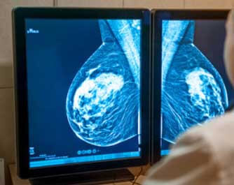 Radiologue Cabinet De Radiologie Et D Echographie Docteurs Vergez SAINT GERMAIN DE LUSIGNAN