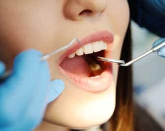 Dentiste Hernie Régine SAINT PRYVE SAINT MESMIN